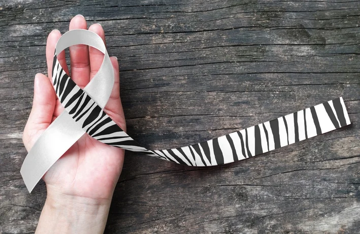 A hand facing palm up with a zebra print ribbon on top. The zebra print ribbon represents rare diseases